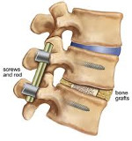 Center for Spine Care