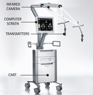 Knee Replacement