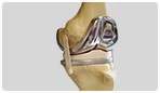 Orthopedic Hospital Ahmedabad, Knee & Hip Joint Replacement Surgery